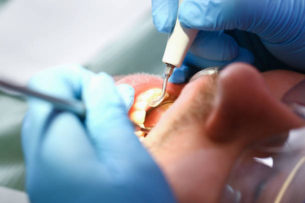 Best Emergency Orthodontic Repairs in Rollingwood, CA